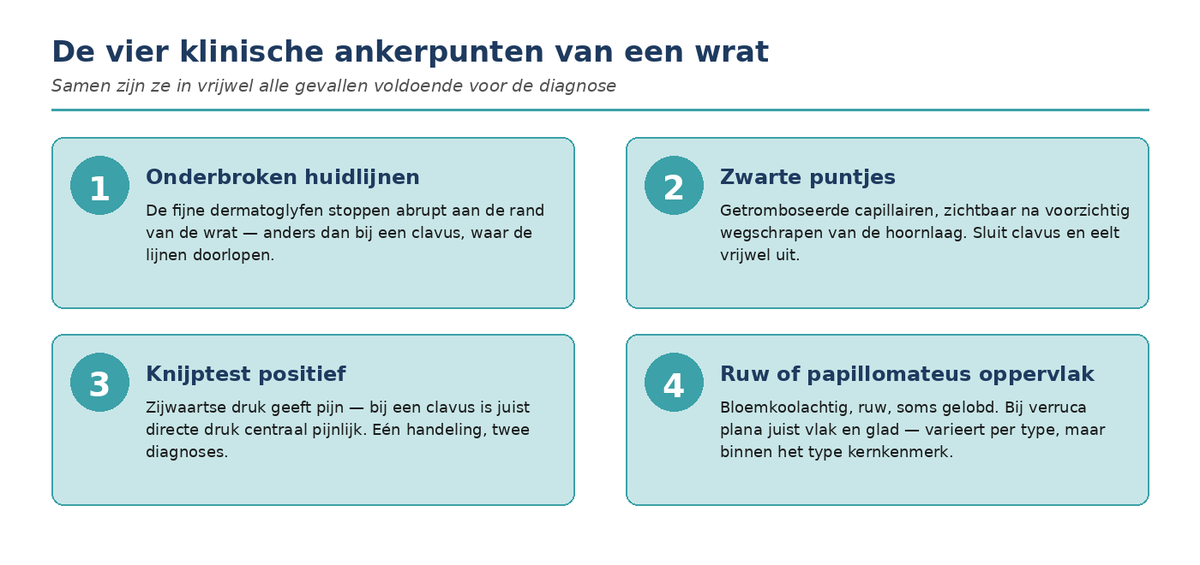 De vier klinische ankerpunten van een wrat